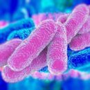 combatir plaga de legionella