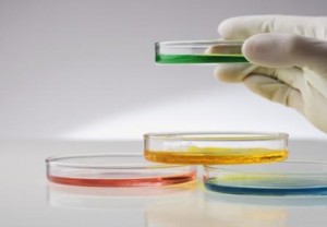 bacteria