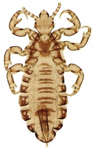 Piojo de la cabeza